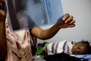 On 30 July, Falso Mohammed Mohammed looks at an X-ray image of her daughter, Fara, in an outpatient clinic on the grounds of the African Union Mission for Somalia (AMISOM) base in Mogadishu, the capital. Fara was shot, and the bullet remains in her stomach (and is visible on the X-ray).