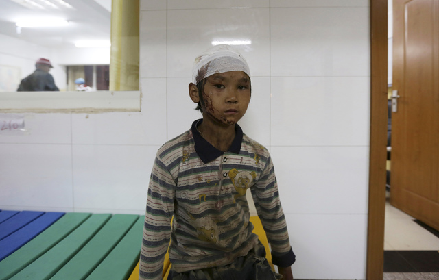 Yang Hongshun, 9, is seen at a hospital after he was injured in an earthquake in Ludian county of Zhaotong, Yunnan province August 3, 2014. A magnitude 6.3 earthquake struck southwestern China on Sunday, killing at least 175 people and leaving more than 180 missing and 1,400 injured in a remote area of Yunnan province, causing thousands of buildings, including a school, to collapse. REUTERS/Wong Campion (CHINA - Tags: HEALTH DISASTER) - RTR4134J