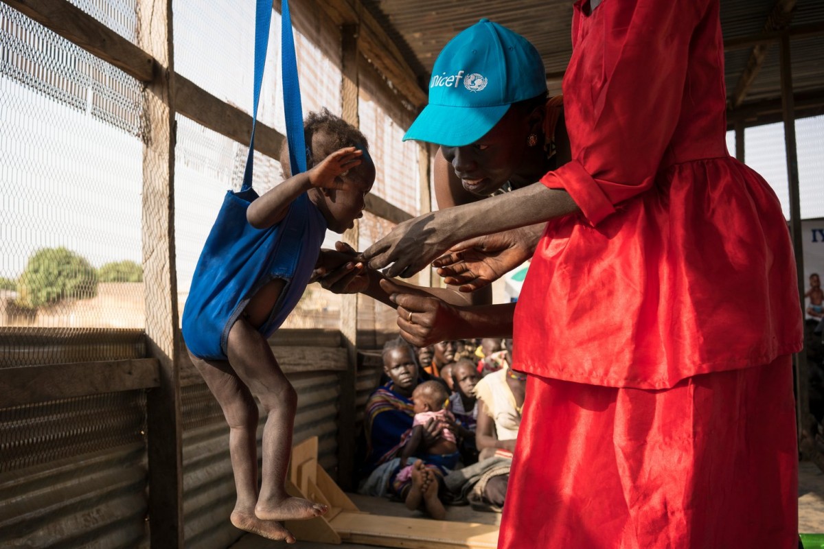 time is running out for children as famine, dro