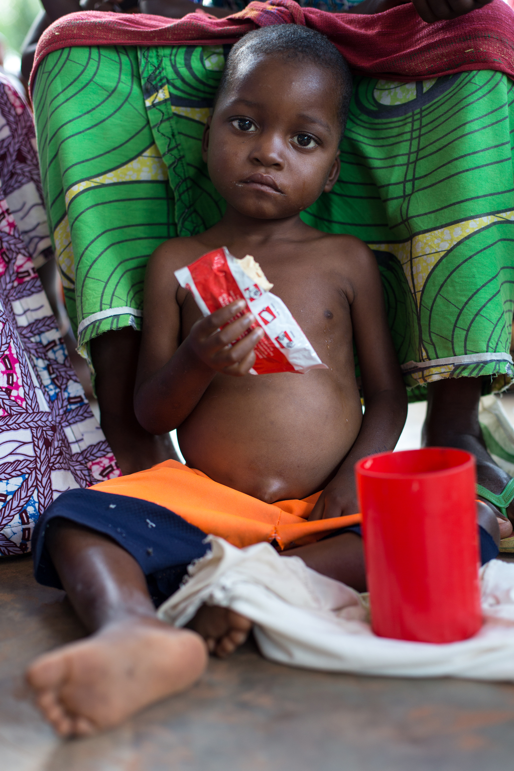 A child suffering from malnutrition is feeding himself with Plumpy Nut - ready-to-use therapeutic food - offered by UNICEF to the health center of Tshinyama, a village near Miabi, located 30 km north-west of Mbuji-mayi, in the direction of Kananga, in the province of Kasai Orientale, in the south Of the Democratic Republic of the Congo, a region plagued by conflict between the militia of the traditional leader Kamuina Nsapu and the Armed Forces of the Democratic Republic of the Congo (FARDC) since June 2016. - Un enfant souffrant de malnutrition se nourrit de « Plumpy Nut », de la nourriture thérapeutique prête à l'emploi, offerte par l'UNICEF au centre de santé de Tshinyama, un petit village proche de Miabi, situé à 30 km au nord-ouest de Mbuji-mayi, en direction de Kananga, dans la province du Kasaï Orientale, au sud de la République démocratique du Congo, une région en proie aux conflits entre les miliciens du chef traditionnel Kamuina Nsapu et les Forces Armées de la République Démocratique du Congo (FARDC) depuis juin 2016. In August 2016, fighting broke out in one of the Democratic Republic of Congos (DRC) poorest regions - Kasai - after a traditional leader was killed in clashes with security forces. The situation deteriorated in 2017, unleashing a wave of violence that has now engulfed nine of the countrys 26 provinces.