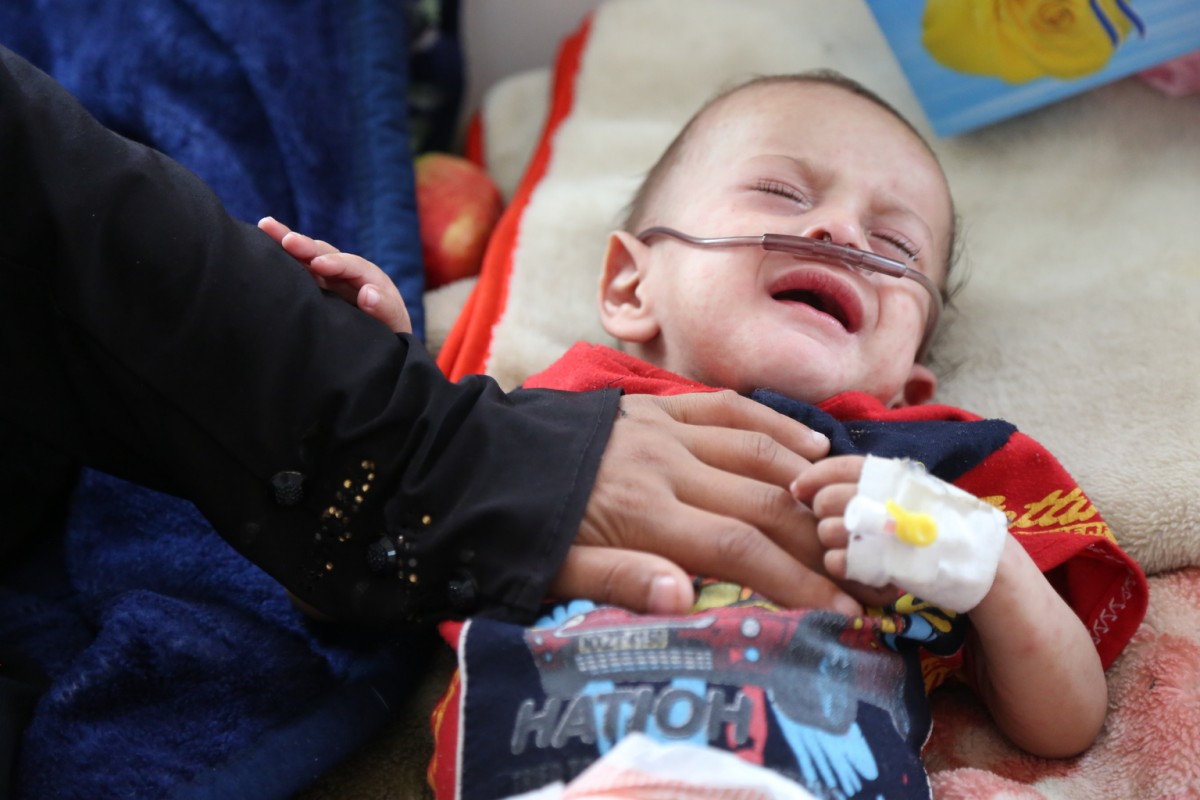A boy suffering from measles receives treatment at Al-Jumhouri Hospital, Sa’ada, Yemen Sa’ada, Yemen, Thursday 21 July 2016.

As of November 2016, almost two years of conflict in Yemen have left 18.8 million people - some 70 per cent of the population - in need of humanitarian assistance. After the United Nations-backed peace talks were suspended in August 2016, airstrikes and hostilities intensified and civilians are paying the price. Close to 4,000 civilians have died as a direct result of the conflict, including 1,332 children. At least 14.5 million people lack access to safe water and sanitation and 14.8 million have limited or no access to health services, compounding a cholera crisis that has put 7.6 million people at risk. The nutrition situation has deteriorated, with 3.3 million children and pregnant or lactating women suffering from acute malnutrition and more than 460,000 children under 5 suffering from severe acute malnutrition (SAM). The near collapse of national services has left an estimated 2 million children out of school. Almost 2.2 million internally displaced persons, nearly half of them children, as well as 1 million returnees and many host communities are also in need of assistance. Ongoing conflict and the deteriorating economic situation have put essential public services such as health on the verge of collapse, leaving children and women at even higher risk.