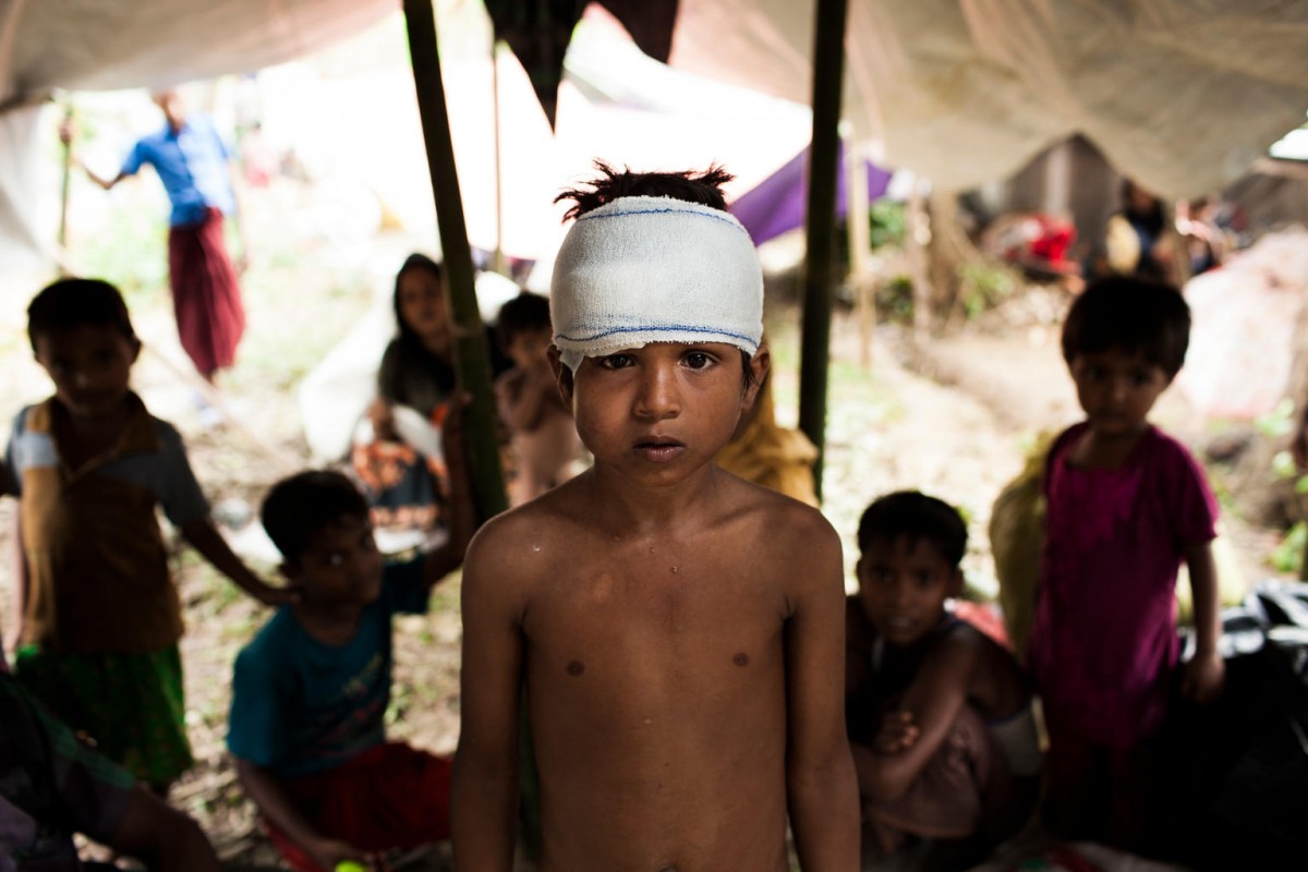On 5 September 2017 in Bangladesh, Mohammed Yasin, 8, is amongst the newly arrived Rohingyas living in shelters at the Kutupalong makeshift camp in Cox's Bazar.

By 5 September 2017, more than 146,000 Rohingya refugees fled across the border from Rakhine State, Myanmar, into Cox's Bazar district, Chittagong Division in Bangladesh since 25 August. As many as 80 per cent of the new arrivals are women and children. More than 70 000 children need urgent humanitarian assistance. More than 100,000 of the newly arrived refugees are currently residing in makeshift settlements and official refugee camps that are extremely overcrowded while 10,000 newly arrived refugees are in host communities. In addition, 33,000 arrivals are in new spontaneous sites, which are quickly expanding.  While some refugees are making their own shelters, the majority of people are staying in the open, suffering from exhaustion, sickness and hunger. Cox’s Bazar district of Bangladesh is one of the most vulnerable districts, not only for its poor performance in child related indicators but also for its vulnerability to natural hazards.  Most people walked 50 or 60 kilometers for up to six days and are in dire need of food, water and protection. Many children are suffering from cold fever as they are drenched in rain and lack additional clothes. Children and adolescents, especially girls, are vulnerable to trafficking as different child trafficking groups are active in the region. Many more children in need of support and protection remain in the areas of northern Rakhine State that have been wracked by violence.

In Bangladesh, UNICEF is scaling up its response to provide refugee children with protection, nutrition, health, water and sanitation support. With the recent influx of refugees, demand has increased and UNICEF is working to mobilize more support and strengthen its existing activities. For recreational and psychosocial support to the newly arrived Rohingya children, 33 mobile Child Frien