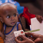 UNICEF: An additional 6.7 million children under 5 could suffer from wasting  this year due to COVID-19