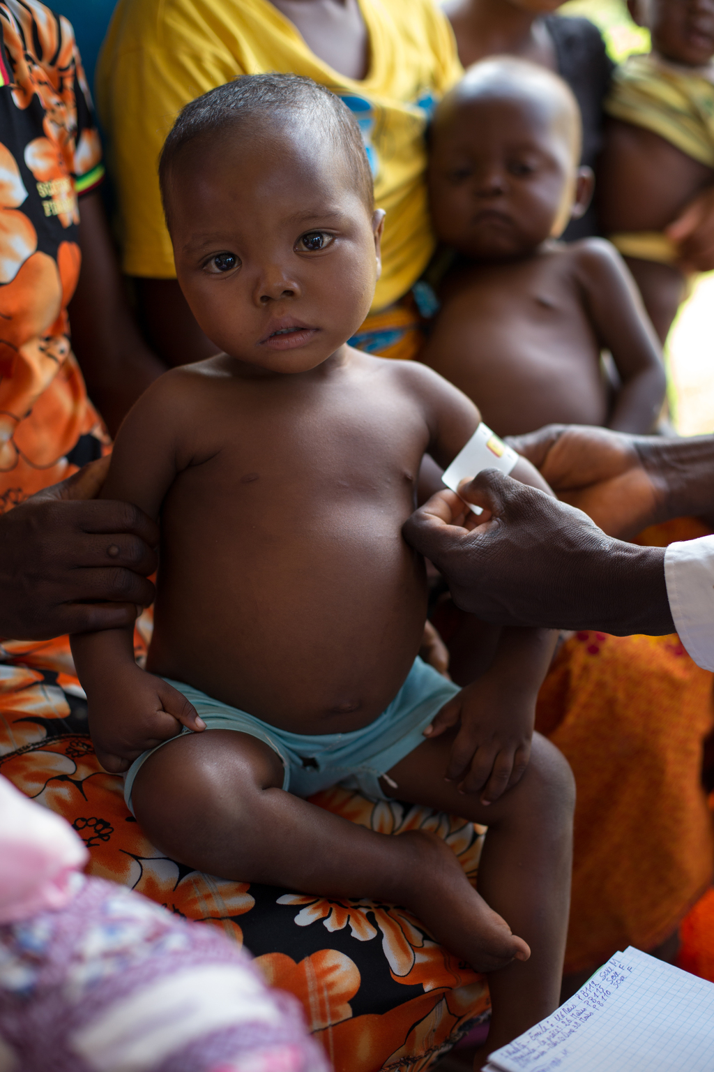 A nurse is screening for cases of malnutrition in the health center of Tshinyama, a village near Miabi, located 30 km north-west of Mbuji-mayi, in the direction of Kananga, in the province of Kasai Orientale, in the south Of the Democratic Republic of the Congo, a region plagued by conflict between the militia of the traditional leader Kamuina Nsapu and the Armed Forces of the Democratic Republic of the Congo (FARDC) since June 2016. - Un infirmier effectue le dépistage de cas de malnutrition dans le centre de santé de Tshinyama, un petit village proche de Miabi, situé à 30 km au nord-ouest de Mbuji-Mayi, en direction de Kananga, dans la province du Kasaï Orientale, au sud de la République Démocratique du Congo, une région en proie aux conflits entre les miliciens du chef traditionnel Kamuina Nsapu et les Forces Armées de la République démocratique du Congo (FARDC) depuis juin 2016. In August 2016, fighting oke out in one of the Democratic Republic of Congos (DRC) poorest regions - Kasai - after a traditional leader was killed in clashes with security forces. The situation deteriorated in 2017, unleashing a wave of violence that has now engulfed nine of the countrys 26 provinces.