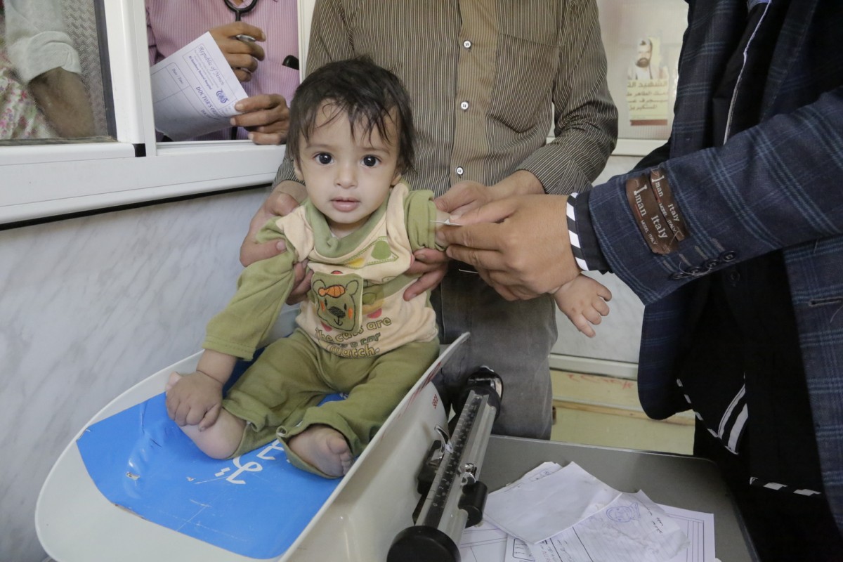 On 6 May 2016 in Yemen, a baby is screened for malnutrition at the UNICEF- supported Al-Jomhouri Hospital in Saada.